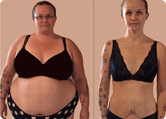  Lipo Jelly Reviews 2